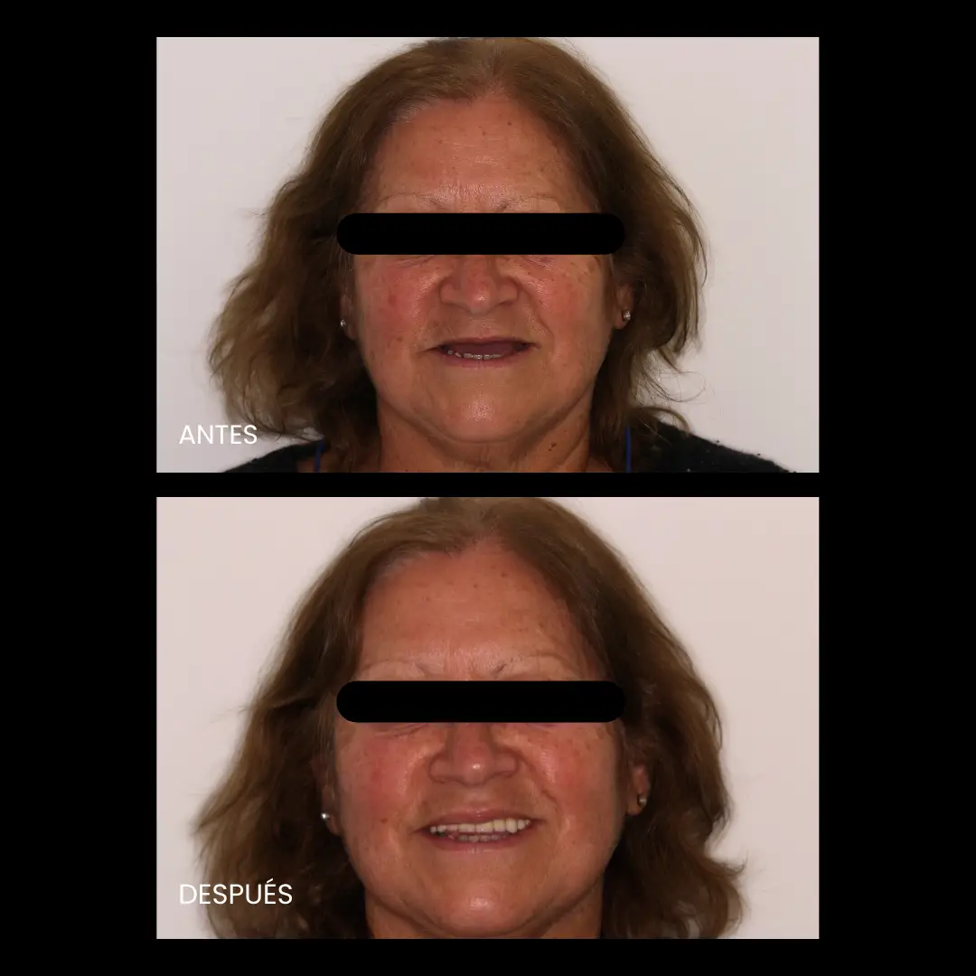 Dr. Francisco Ortiz, Cirujano Dentista e Implantólogo especializado en tratamientos avanzados de implantología y rehabilitación oral. Experiencia, precisión y cuidado en cada sonrisa.