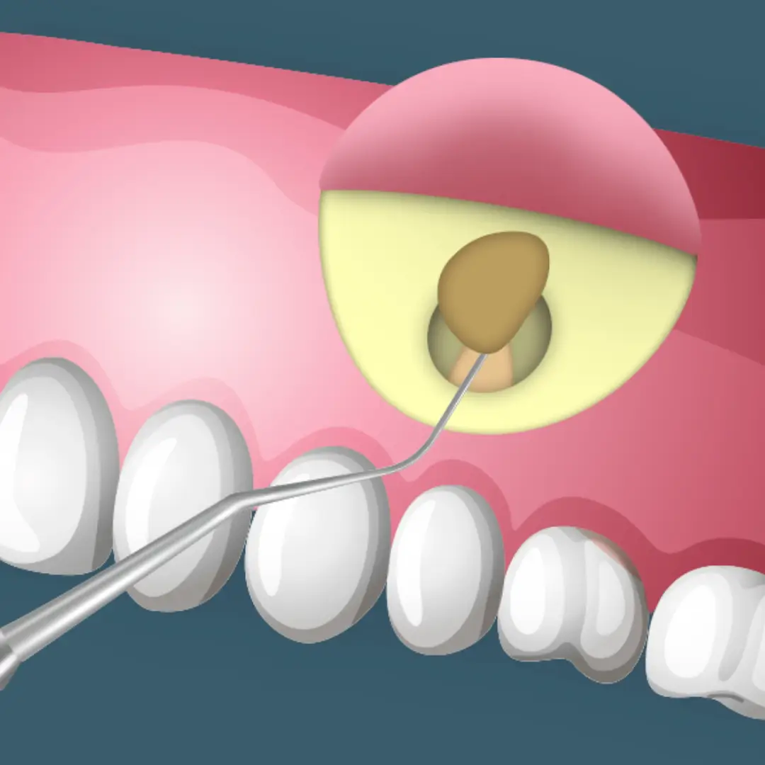 Dr. Francisco Ortiz, Cirujano Dentista e Implantólogo especializado en tratamientos avanzados de implantología y rehabilitación oral. Experiencia, precisión y cuidado en cada sonrisa.