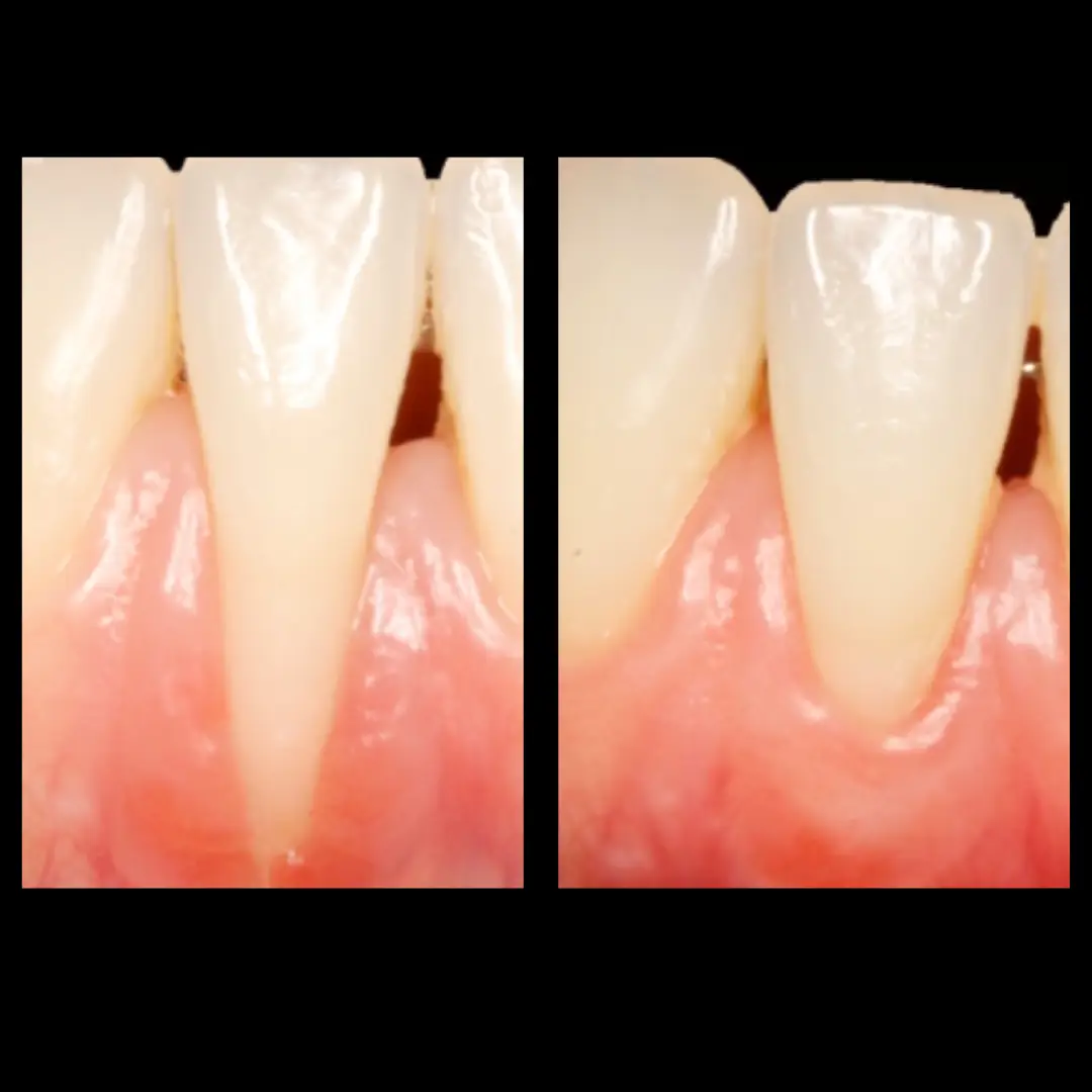 Dr. Francisco Ortiz, Cirujano Dentista e Implantólogo especializado en tratamientos avanzados de implantología y rehabilitación oral. Experiencia, precisión y cuidado en cada sonrisa.