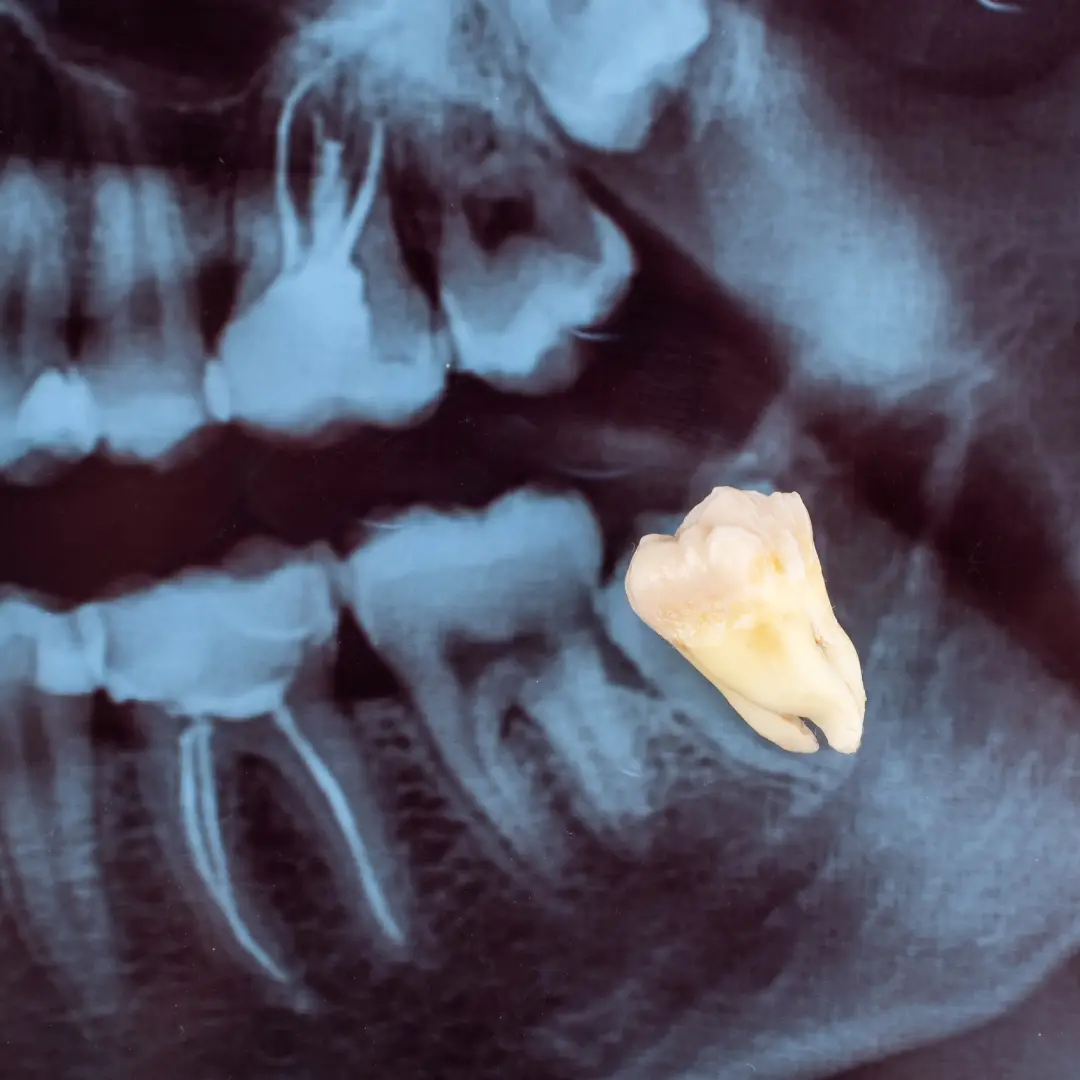 Dr. Francisco Ortiz, Cirujano Dentista e Implantólogo especializado en tratamientos avanzados de implantología y rehabilitación oral. Experiencia, precisión y cuidado en cada sonrisa.