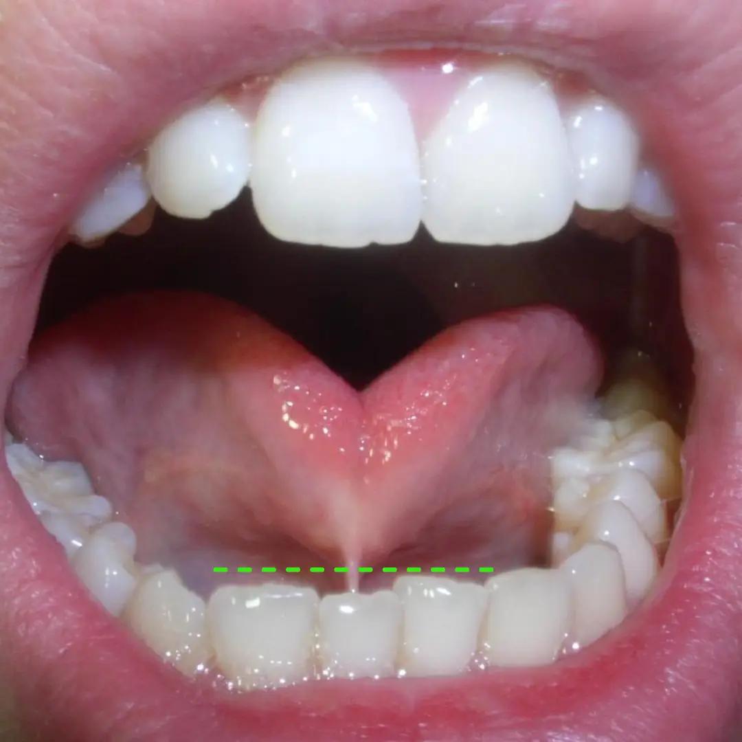 Dr. Francisco Ortiz, Cirujano Dentista e Implantólogo especializado en tratamientos avanzados de implantología y rehabilitación oral. Experiencia, precisión y cuidado en cada sonrisa.