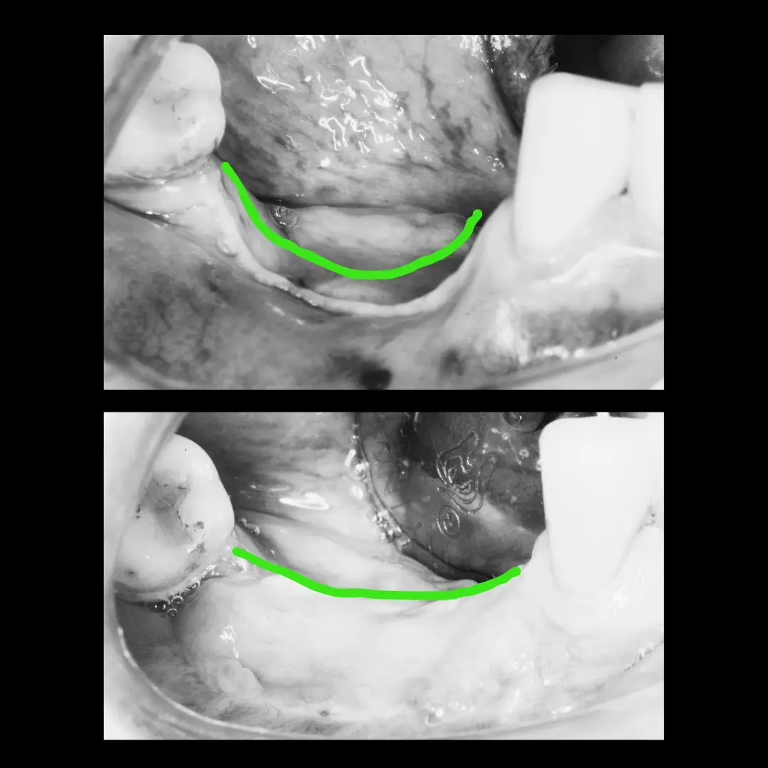 Dr. Francisco Ortiz, Cirujano Dentista e Implantólogo especializado en tratamientos avanzados de implantología y rehabilitación oral. Experiencia, precisión y cuidado en cada sonrisa.